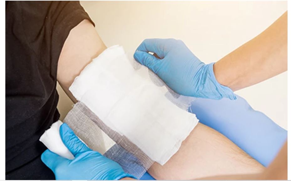Magic Bandage Developed to Heal Burn Wounds